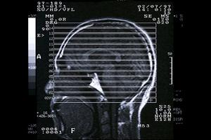 大切な眼の治療を安心して任せられる眼科