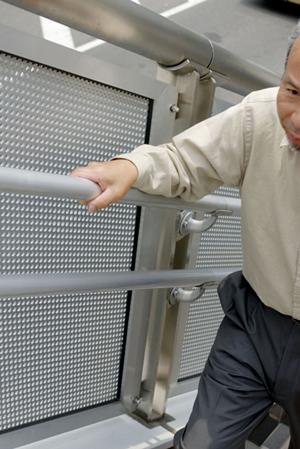 川越の生活を向上させるインプラント